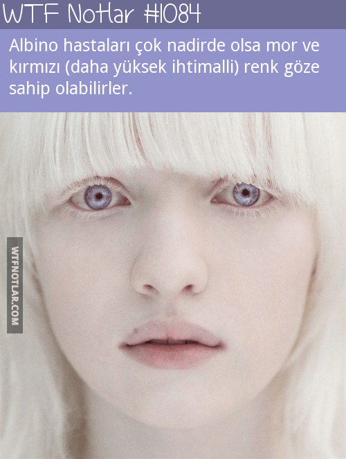 Mor ve Kırmızı gözler, Albino 1
