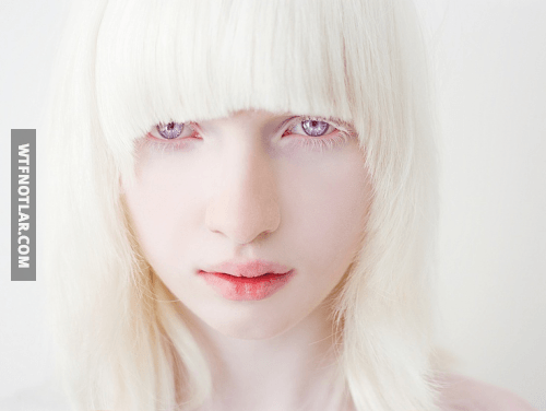 Mor ve Kırmızı gözler, Albino 2